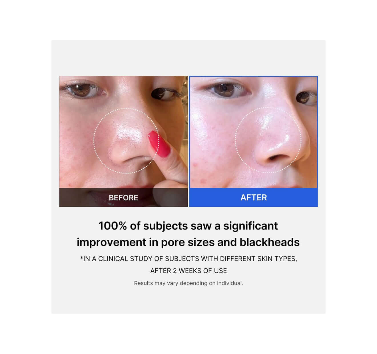 View details for Medicube Zero Pore Pad 2.0-70pcs Medicube Zero Pore Pad 2.0-70pcs