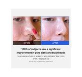 View details for Medicube Zero Pore Pad 2.0-70pcs Medicube Zero Pore Pad 2.0-70pcs